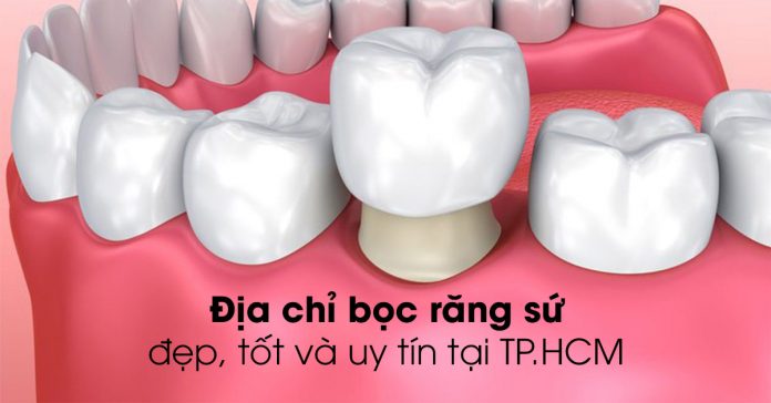 địa chỉ bọc răng sứ thẩm mỹ TPHCM