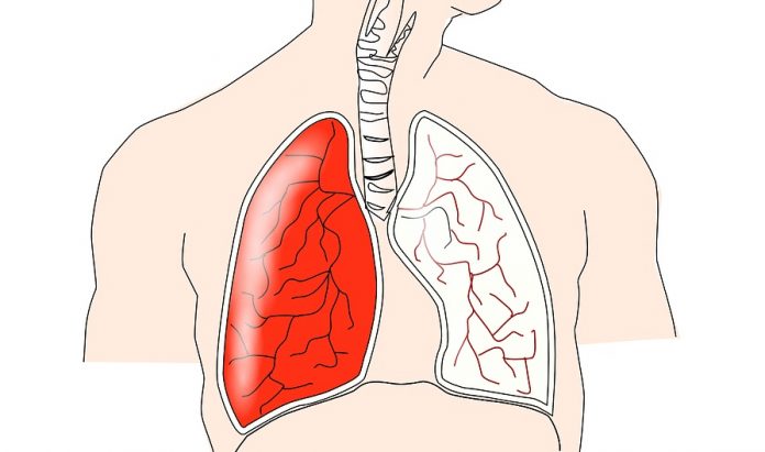 địa chỉ khám phổi tốt ở Hà Nội