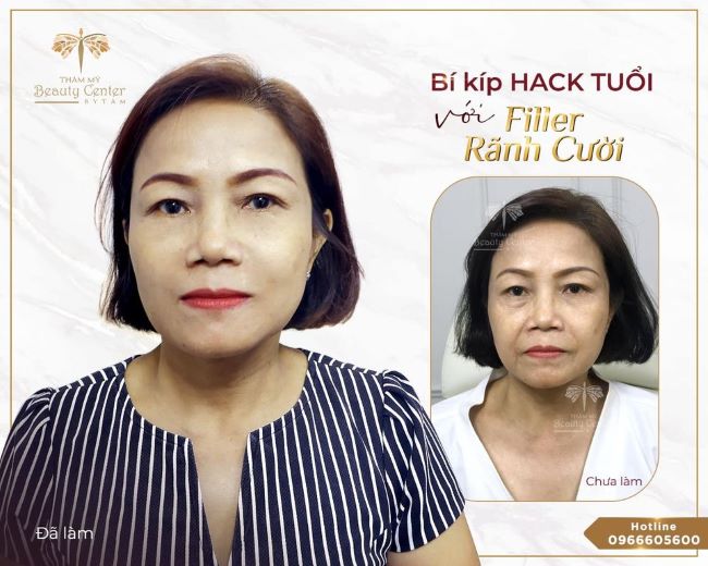 Beauty Center by Tấm có 10 năm kinh nghiệm và có thể giúp bạn loại bỏ các nếp nhăn và đồi mồi để mang lại cho bạn vẻ ngoài trẻ trung hơn | Nguồn: Beauty Center by Tấm