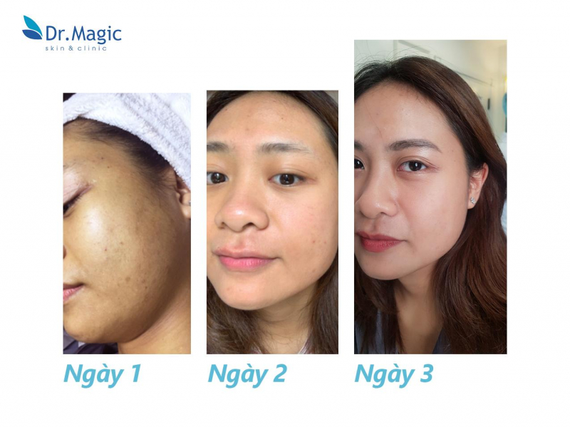 địa chỉ trị mụn uy tín Hà Nội- Trung Tâm Dr. Magic Skin & Clinic