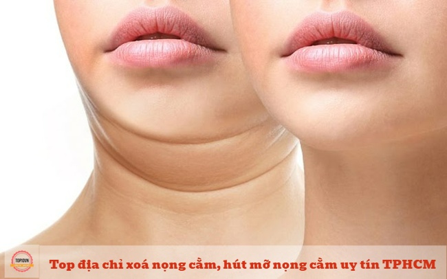 ISEUL cố gắng mang đến cho khách hàng kết quả trông tự nhiên nhất có thể bằng các công cụ và kỹ thuật hiện đại nhất | Nguồn: ISEUL 