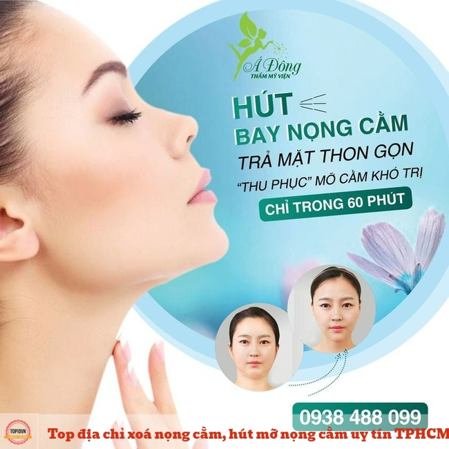 Thẩm mỹ viện Á Đông có quy trình hút mỡ nọng cằm tại TP.HCM sẽ luôn đảm bảo an toàn cho bệnh nhân, cũng như được các bác sĩ thăm khám và chăm sóc kỹ lưỡng | Nguồn: Thẩm mỹ viện Á Đông