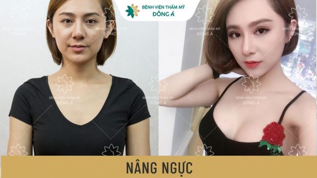 Bệnh viện thẩm mỹ Đông Á mang đến cho các chị em những giải pháp làm đẹp bằng công nghệ tiên tiến với chất lượng dịch vụ chuyên nghiệp | Nguồn: Bệnh viện thẩm mỹ Đông Á