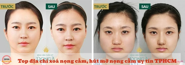 Thẩm mỹ viện Đông Á là nơi quy tụ đội ngũ bác sĩ có trình độ chuyên môn cao, được tu nghiệp chuyên sâu tại các nước như Hàn Quốc, Thái Lan, Hoa Kỳ | Nguồn: Thẩm mỹ viện Đông Á