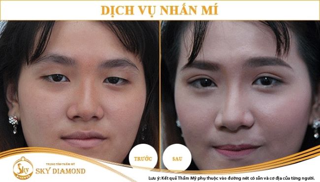 Các liệu pháp thẩm mỹ và làm đẹp tại Sky Diamond Beauty Center đã làm hài lòng hàng trăm người tiêu dùng trong suốt nhiều năm qua | Nguồn: Sky Diamond Beauty Center