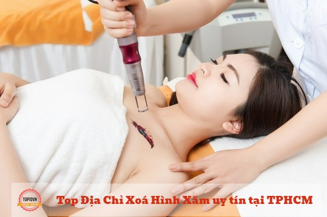 Saigon Smile Spa sẽ giúp bạn xóa hình xăm hoàn toàn, an toàn, thành công mà vẫn giữ nguyên hình dạng ban đầu | Nguồn: Saigon Smile Spa