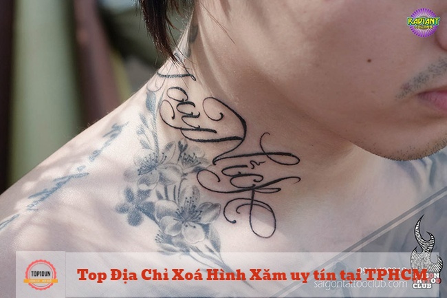 Saigon Tattoo Group là nơi bạn sẽ tìm thấy nhiều bác sĩ giỏi, có bằng cấp cao cũng như hệ thống cơ sở vật chất, trang thiết bị hiện đại được đồng bộ hóa | Nguồn: Saigon Tattoo Group