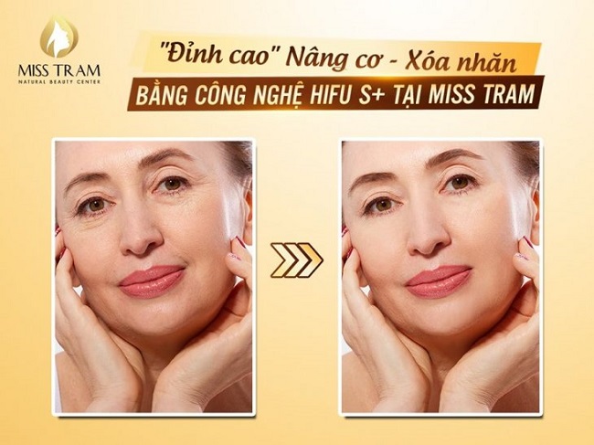 Miss Tram đã hoạt động hơn 15 năm và được đánh giá cao và hiệu quả bởi đội ngũ chuyên gia tại đây am hiểu từng loại da và cách điều trị | Nguồn: Miss Tram